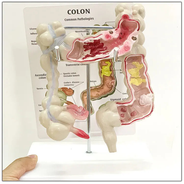 Medical Human Anatomical Intestine Model The Void