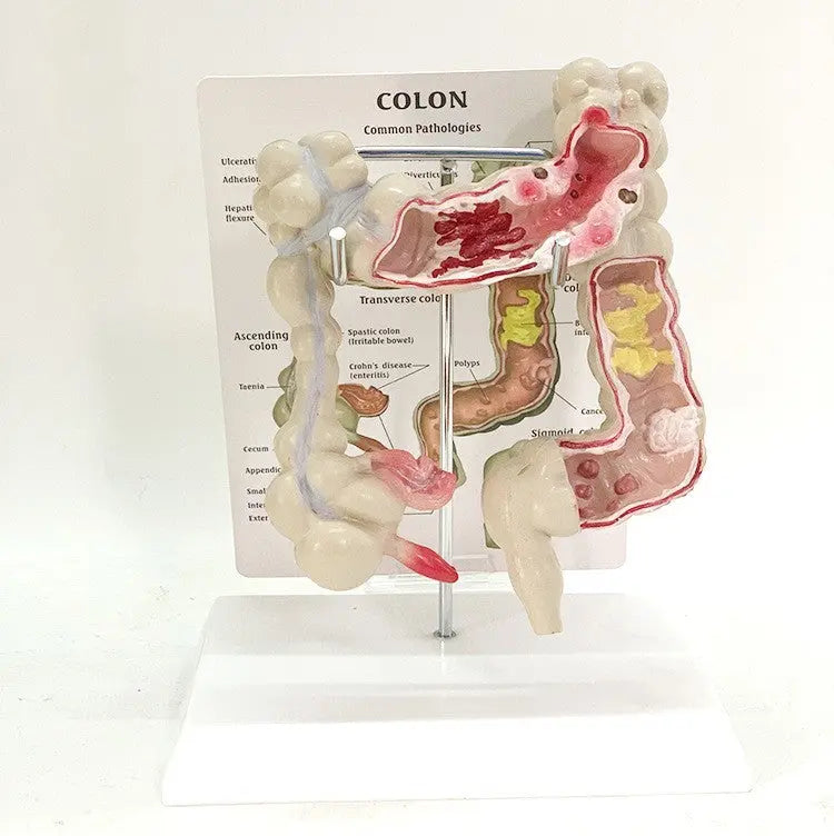 Medical Human Anatomical Intestine Model The Void