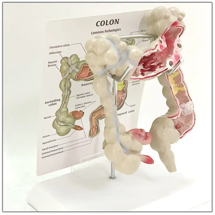 Medical Human Anatomical Intestine Model The Void