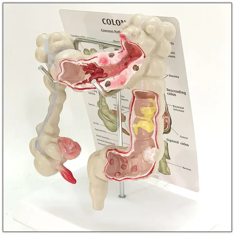 Medical Human Anatomical Intestine Model The Void