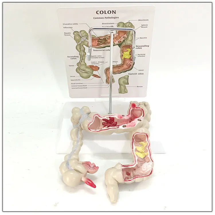 Medical Human Anatomical Intestine Model The Void