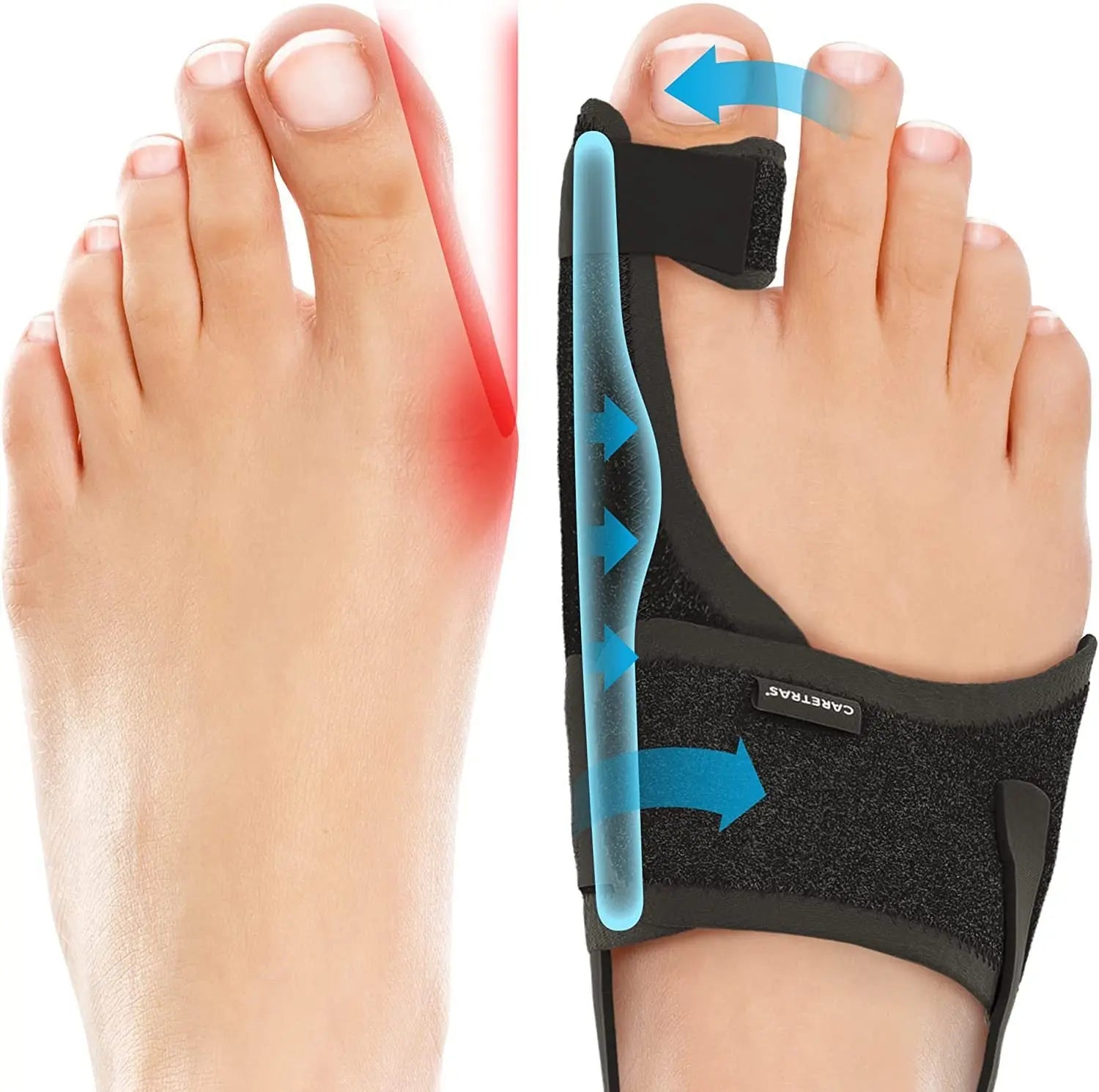 Big Toe Brace Hallux Valgus Orthotics Band The Void